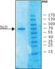 图片 链球菌溶血素O来源于化脓链球菌，Streptolysin O from Streptococcus pyogenes [SLO]；≥1,000,000 units/mg protein, recombinant, lyophilized powder, expressed in E. coli